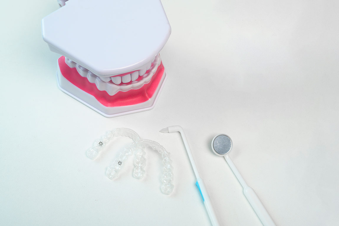 Support Following Invisalign Treatment