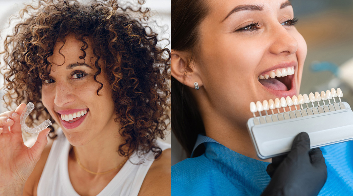 Invisalign vs. Veneers: Which is the Right Choice for Your Smile Makeover?
