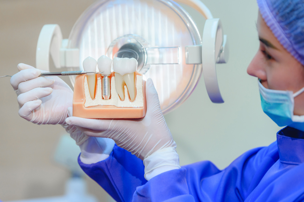 Dental Implants and Bone Health: What You Need to Know