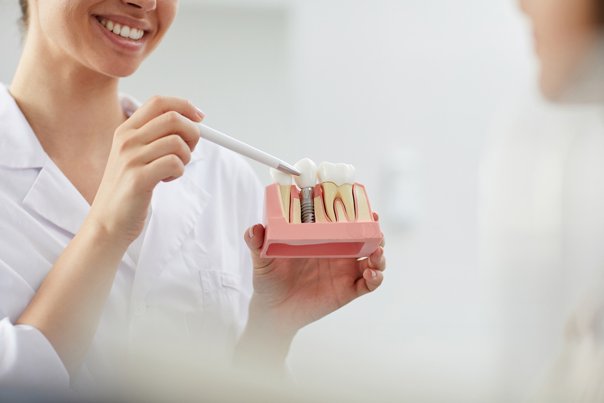 Caring for Your Dental Implants: Tips for Long-Term Success